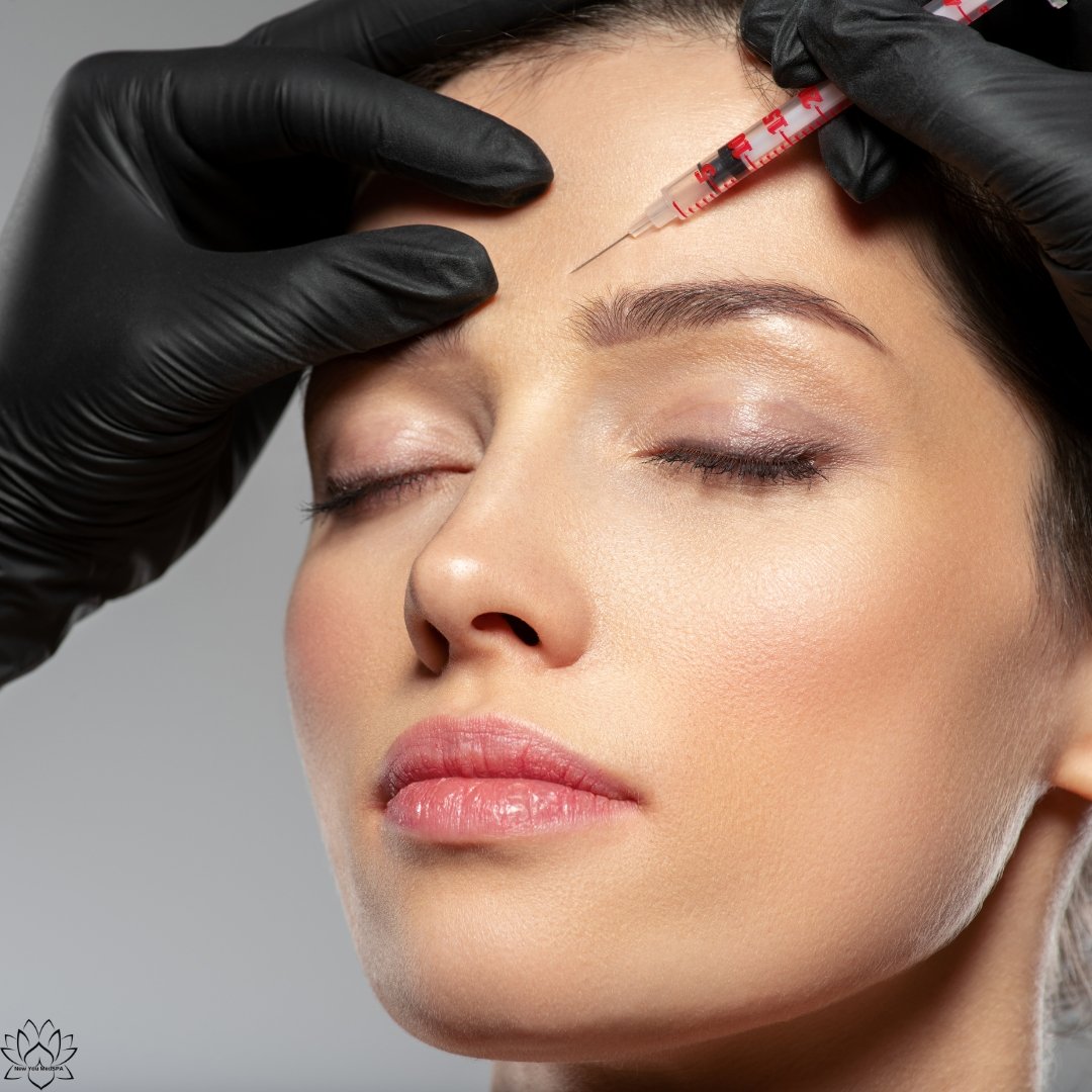 botox botox